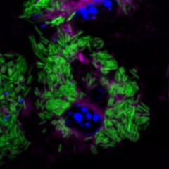Listeria under the microscope - like an underwater coral reef at night with lights shone on the coral