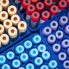 Four different coloured test tubes 